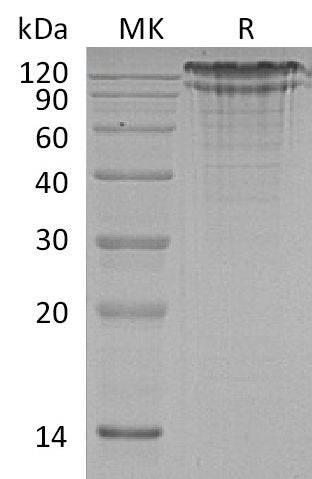 BL-0706NP: Greater than 95% as determined by reducing SDS-PAGE. (QC verified)Recombinant Human LDL R Protein (C-6His)