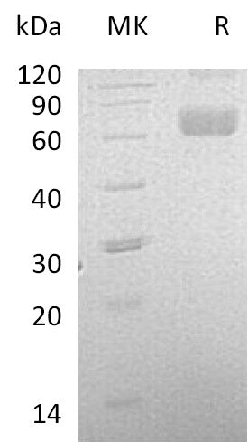 BL-0707NP: Greater than 95% as determined by reducing SDS-PAGE. (QC verified)Recombinant Human LCAT Protein (C-6His)