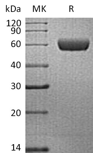 BL-0028NP: Greater than 95% as determined by reducing SDS-PAGE. (QC verified)Recombinant Human PDPN Protein (C-Fc)