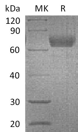 BL-0029NP: Greater than 95% as determined by reducing SDS-PAGE. (QC verified)Recombinant Mouse IL-4RA Protein (C-Fc)