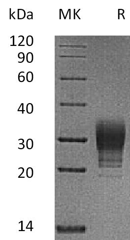 BL-0709NP: Greater than 95% as determined by reducing SDS-PAGE. (QC verified)Recombinant Human CREG Protein (C-6His)