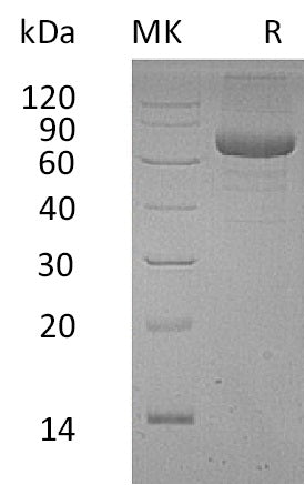 BL-1429NP: Greater than 95% as determined by reducing SDS-PAGE. (QC verified)Recombinant Human PSG9 Protein (C-6His)