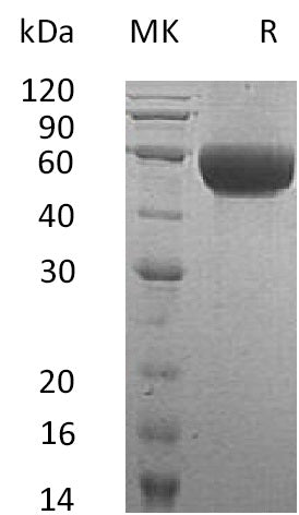 BL-0718NP: Greater than 95% as determined by reducing SDS-PAGE. (QC verified)Recombinant Human NTRI Protein (C-6His)