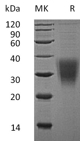 BL-2560NP: Greater than 95% as determined by reducing SDS-PAGE. (QC verified)Recombinant Human NKG2A Protein (N-8His)