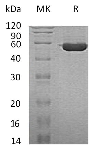 BL-1428NP: Greater than 95% as determined by reducing SDS-PAGE. (QC verified)Recombinant Human TINAGL1 Protein (C-6His)