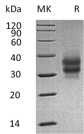 BL-0721NP: Greater than 95% as determined by reducing SDS-PAGE. (QC verified)Recombinant Mouse FOLR1 Protein (C-6His)