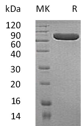 BL-1431NP: Greater than 95% as determined by reducing SDS-PAGE. (QC verified)Recombinant Human ALPP Protein (C-6His)