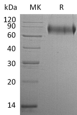 BL-0720NP: Greater than 95% as determined by reducing SDS-PAGE. (QC verified)Recombinant Human E-selectin Protein (C-6His)