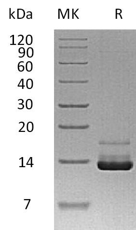 BL-1845NP: Greater than 95% as determined by reducing SDS-PAGE. (QC verified)Recombinant Human PTH Protein (N-8His)