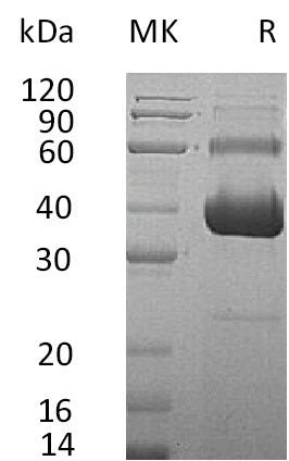 BL-1237NP: Greater than 95% as determined by reducing SDS-PAGE. (QC verified)Recombinant Human ACVR2A Protein (C-Fc-6His)