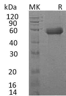 BL-0728NP: Greater than 95% as determined by reducing SDS-PAGE. (QC verified)Recombinant Human IL-18RAcP Protein (C-6His)