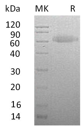 BL-0729NP: Greater than 95% as determined by reducing SDS-PAGE. (QC verified)Recombinant Human RSPO3 Protein (C-Fc-6His)