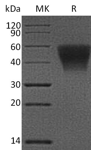 BL-1208NP: Greater than 95% as determined by reducing SDS-PAGE. (QC verified)Recombinant Human CD16b Protein (C-6His)