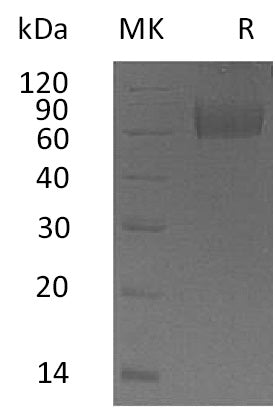 BL-0042NP: Greater than 95% as determined by reducing SDS-PAGE. (QC verified)Recombinant Human IL-18BP Protein (C-Fc)