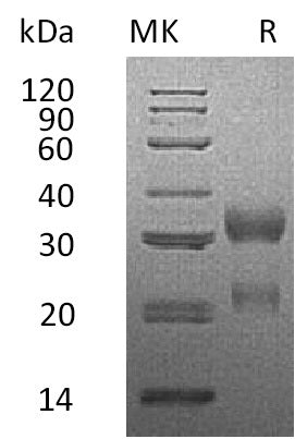 BL-2015NP: Greater than 95% as determined by reducing SDS-PAGE. (QC verified)Recombinant Human CGA&CGB3 Protein (C-Flag,C-6His)
