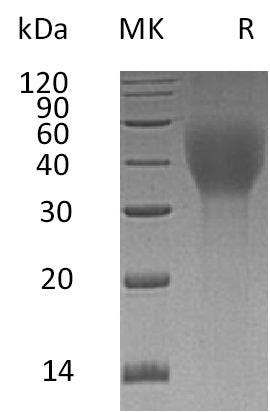 BL-0734NP: Greater than 95% as determined by reducing SDS-PAGE. (QC verified)Recombinant Human TCblR Protein (C-6His)