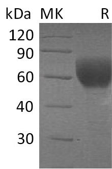 BL-0043NP: Greater than 95% as determined by reducing SDS-PAGE. (QC verified)Recombinant Human TGFBR2 Protein (C-Fc)