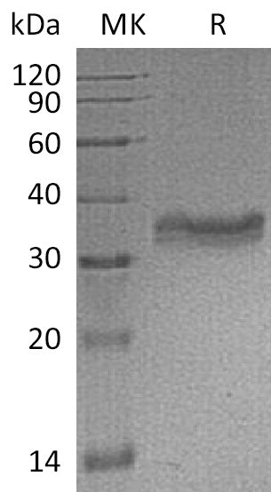 BL-1437NP: Greater than 95% as determined by reducing SDS-PAGE. (QC verified)Recombinant Mouse Carbonic Anhydrase 4 Protein (C-6His)