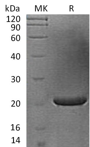 BL-1725NP: Greater than 95% as determined by reducing SDS-PAGE. (QC verified)Recombinant Human FGF-17 Protein