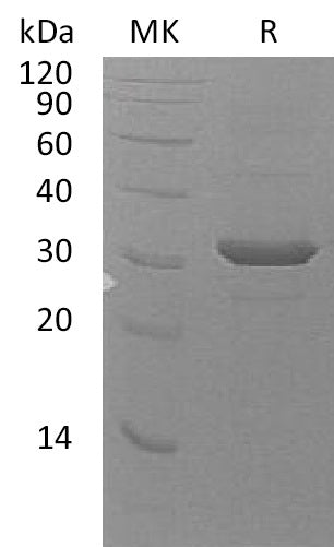 BL-1538NP: Greater than 90% as determined by reducing SDS-PAGE. (QC verified)Recombinant Human UBE2Z Protein (N-6His)