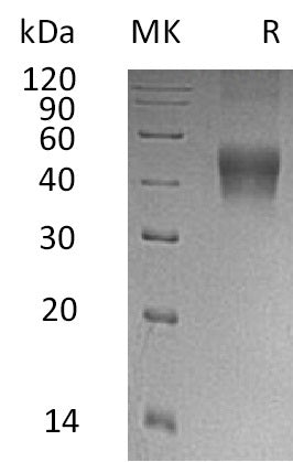 BL-0766NP: Greater than 95% as determined by reducing SDS-PAGE. (QC verified)Recombinant Human IL-21R Protein (C-6His)