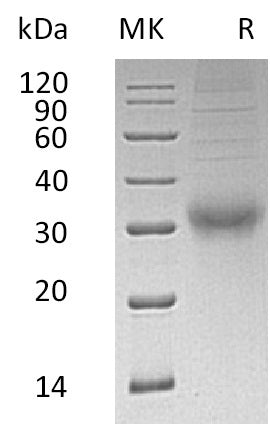 BL-2654NP: Greater than 95% as determined by reducing SDS-PAGE. (QC verified)Recombinant Human CGB Protein (C-6His)