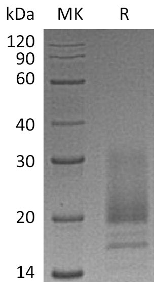 BL-0764NP: Greater than 95% as determined by reducing SDS-PAGE. (QC verified)Recombinant Human VIP Protein (C-6His)