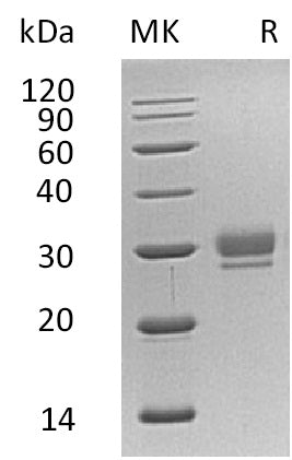 BL-0777NP: Greater than 95% as determined by reducing SDS-PAGE. (QC verified)Recombinant Human CTHRC1 Protein (C-6His)