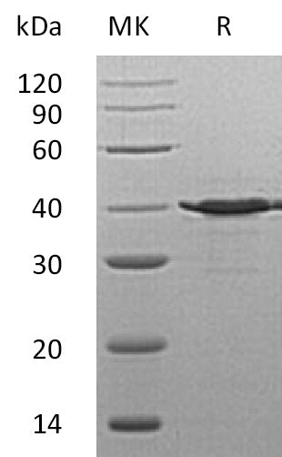 BL-1460NP: Greater than 95% as determined by reducing SDS-PAGE. (QC verified)Recombinant Human TSTA3 Protein (C-6His)