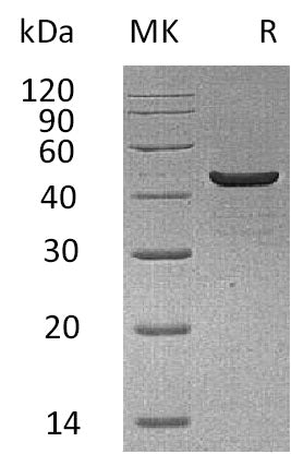 BL-1449NP: Greater than 95% as determined by reducing SDS-PAGE. (QC verified)Recombinant Human CKMM Protein (C-6His)