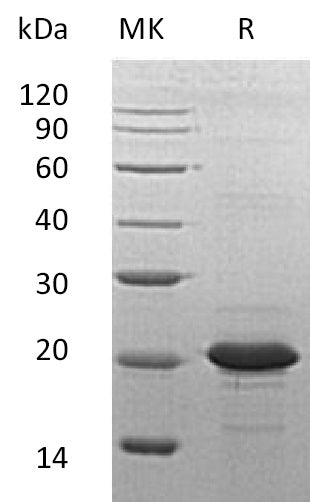 BL-1469NP: Greater than 95% as determined by reducing SDS-PAGE. (QC verified)Recombinant Human SOD1 Protein (N-6His)