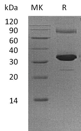 BL-1476NP: Greater than 95% as determined by reducing SDS-PAGE. (QC verified)Recombinant Human GNMT Protein (N-6His)