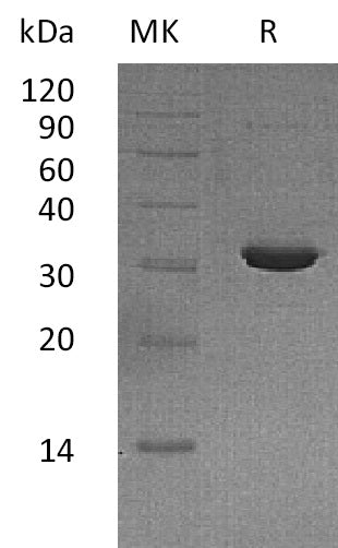BL-1473NP: Greater than 95% as determined by reducing SDS-PAGE. (QC verified)Recombinant Human IMPase2 Protein (N-6His)