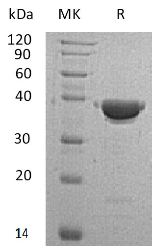 BL-1477NP: Greater than 90% as determined by reducing SDS-PAGE. (QC verified)Recombinant Human AKR1C4 Protein (N-6His)