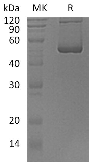 BL-1483NP: Greater than 95% as determined by reducing SDS-PAGE. (QC verified)Recombinant Human SCLY Protein (N-6His)