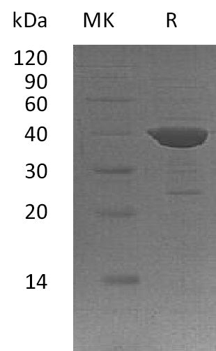 BL-1480NP: Greater than 90% as determined by reducing SDS-PAGE. (QC verified)Recombinant Human ADPRH Protein (N-6His)