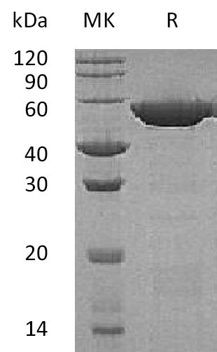 BL-1484NP: Greater than 95% as determined by reducing SDS-PAGE. (QC verified)Recombinant Human GSH-S Protein (C-6His)