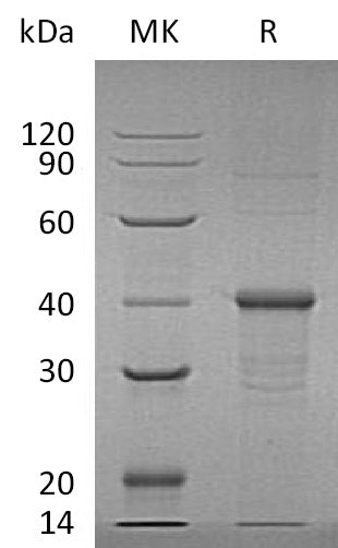BL-1503NP: Greater than 95% as determined by reducing SDS-PAGE. (QC verified)Recombinant Human BDH1 Protein (N-6His)
