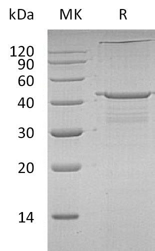 BL-1859NP: Greater than 90% as determined by reducing SDS-PAGE. (QC verified)Recombinant Human IGF2BP-2 Protein (N-T7 ,C-6His)