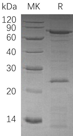 BL-1514NP: Greater than 95% as determined by reducing SDS-PAGE. (QC verified)Recombinant Human VCP Protein (C-6His)