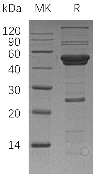 BL-1515NP: Greater than 80% as determined by reducing SDS-PAGE. (QC verified)Recombinant Human ATG4A Protein (N-6His)