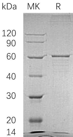 BL-1516NP: Greater than 85% as determined by reducing SDS-PAGE. (QC verified)Recombinant Human BLK Protein (C-6His)