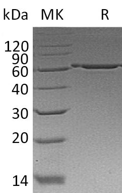 BL-1518NP: Greater than 95% as determined by reducing SDS-PAGE. (QC verified)Recombinant Human P4HB Protein (C-6His)