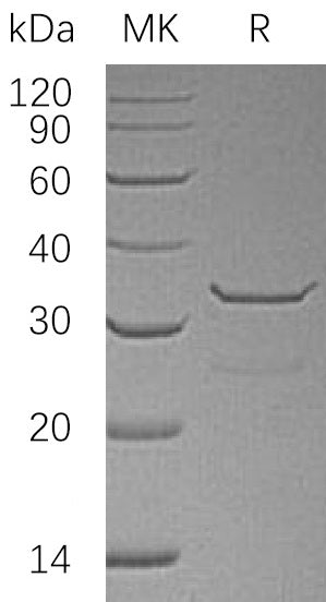 BL-1524NP: Greater than 95% as determined by reducing SDS-PAGE. (QC verified)Recombinant Human SULT1B1 Protein (N-6His)