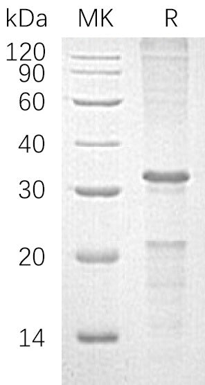 BL-1527NP: Greater than 90% as determined by reducing SDS-PAGE. (QC verified)Recombinant Human CASP10 Protein (C-6His)