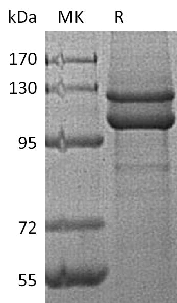 BL-1050NP: Greater than 95% as determined by reducing SDS-PAGE. (QC verified)Recombinant Human CDH1 Protein (C-6His)