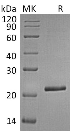 BL-0966NP: Greater than 95% as determined by reducing SDS-PAGE. (QC verified)Recombinant Human TIMP-4 Protein (C-6His)