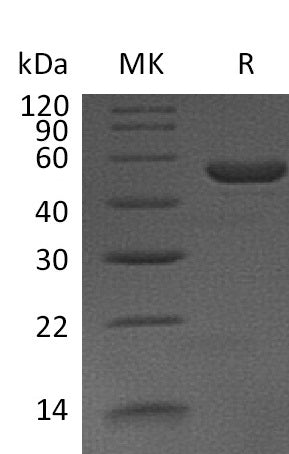 BL-0207NP: Greater than 95% as determined by reducing SDS-PAGE. (QC verified)Recombinant Mouse IL-11 Protein (C-Fc)
