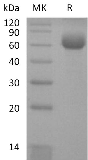 BL-0095NP: Greater than 95% as determined by reducing SDS-PAGE. (QC verified)Recombinant Human CD161 Protein (C-Fc)