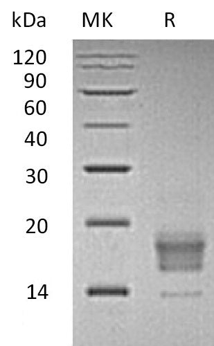 BL-0965NP: Greater than 95% as determined by reducing SDS-PAGE. (QC verified)Recombinant Human TIGIT Protein (C-6His)